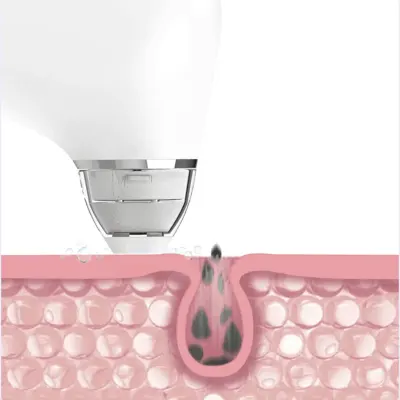 Xiaomi Ultra-Micro Bubble Pore Vacuum Cleaner, Blackhead Remover Electric Acne Machine, Facial Beauty Clean Skin Tool, Doco